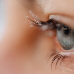 "Augenoperation Grauer Star Dauer der Krankheitszeit"